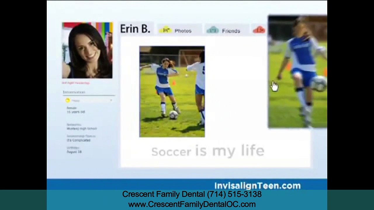 Clear Aligners Anaheim CA