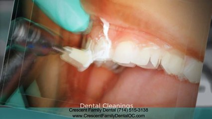 Preventative Dentistry Anaheim CA
