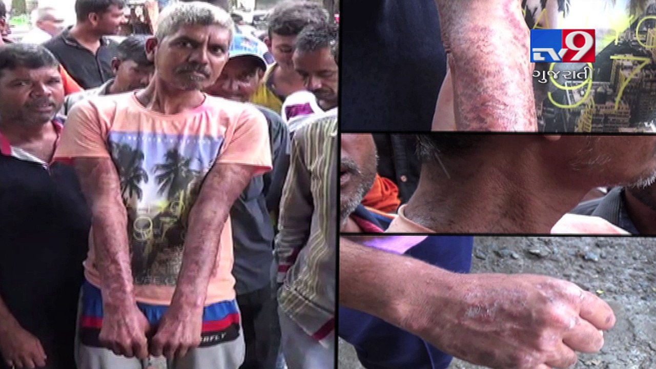 Rajkot: Bhukhi villagers suffer from skin diseases after drinking chemical water of Bhadar river