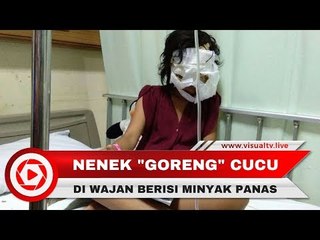 Sadis! Nenek Celupkan Wajah Cucu ke Wajan Berisi Minyak Panas