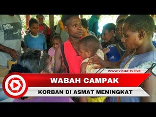 67 Anak Meninggal karena Wabah Campak di Asmat, TNI Kirim Satgas