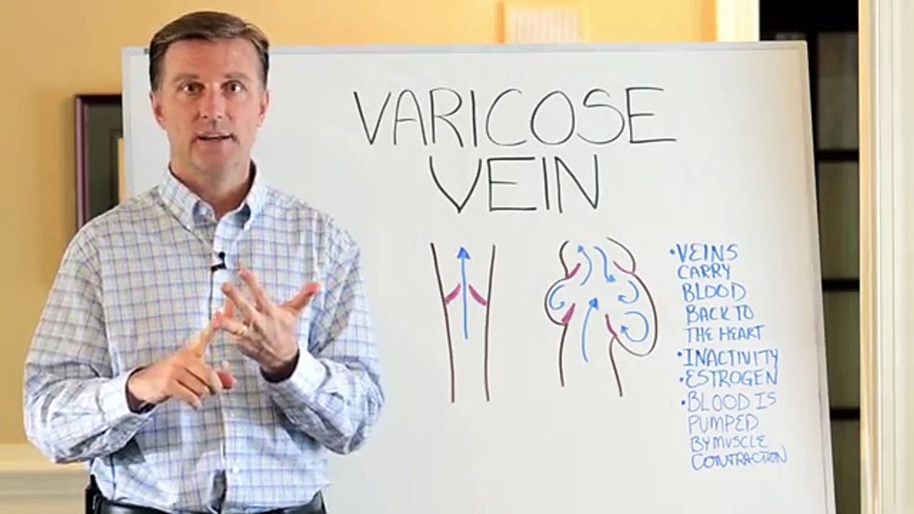 The Best Way to Deal with Varicose Veins!