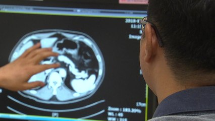 "한국인, 서양인보다 췌장 작아 당뇨병 잘 걸려" / YTN