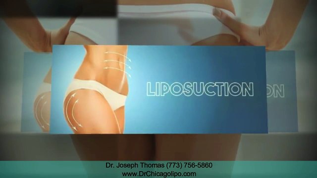 Safe Lipo Chicago IL