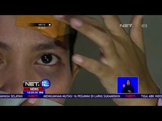 Wanita Korban KDRT Laporkan Polisi-NET12