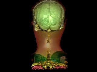 Auto Portrait 3D scanner Head of Sylvain Ordureau