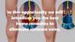 My Grandmother Taught Me These Remedies To Eliminate Varicose veins or Spider veins!Natural Remedies