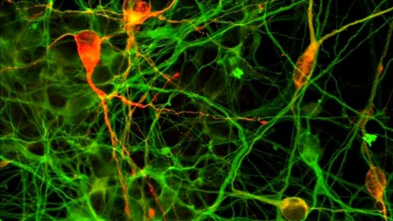 Parkinson: via alla sperimentazione con le staminali sugli esseri umani