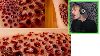 (WARNING GROSS) CURING MY TRYPOPHOBIA