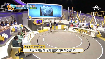 '하체 비만'탈출 어려운 이유, 지방과 염증의 콜라보 때문?