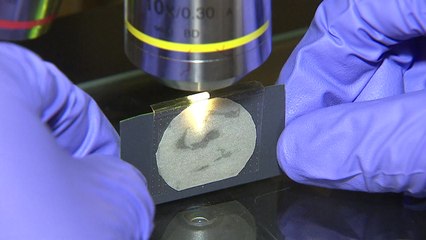 세계 최초 DNA 소재 '니들패치' 상용화 추진 / YTN