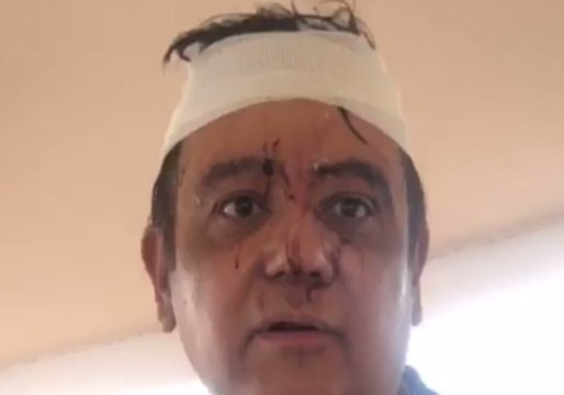 Injured Aeromexico Flight Passengers Exit Durango Airport