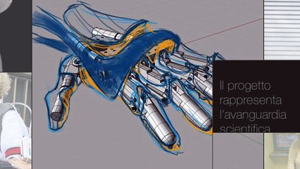 Mano bionica made in Italy, Almerina-' Ora ho di nuovo il tatto' - Notizie.it