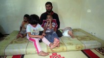 Afrinli Ahmet, eşi ve bebeği için protez bekliyor - AFRİN