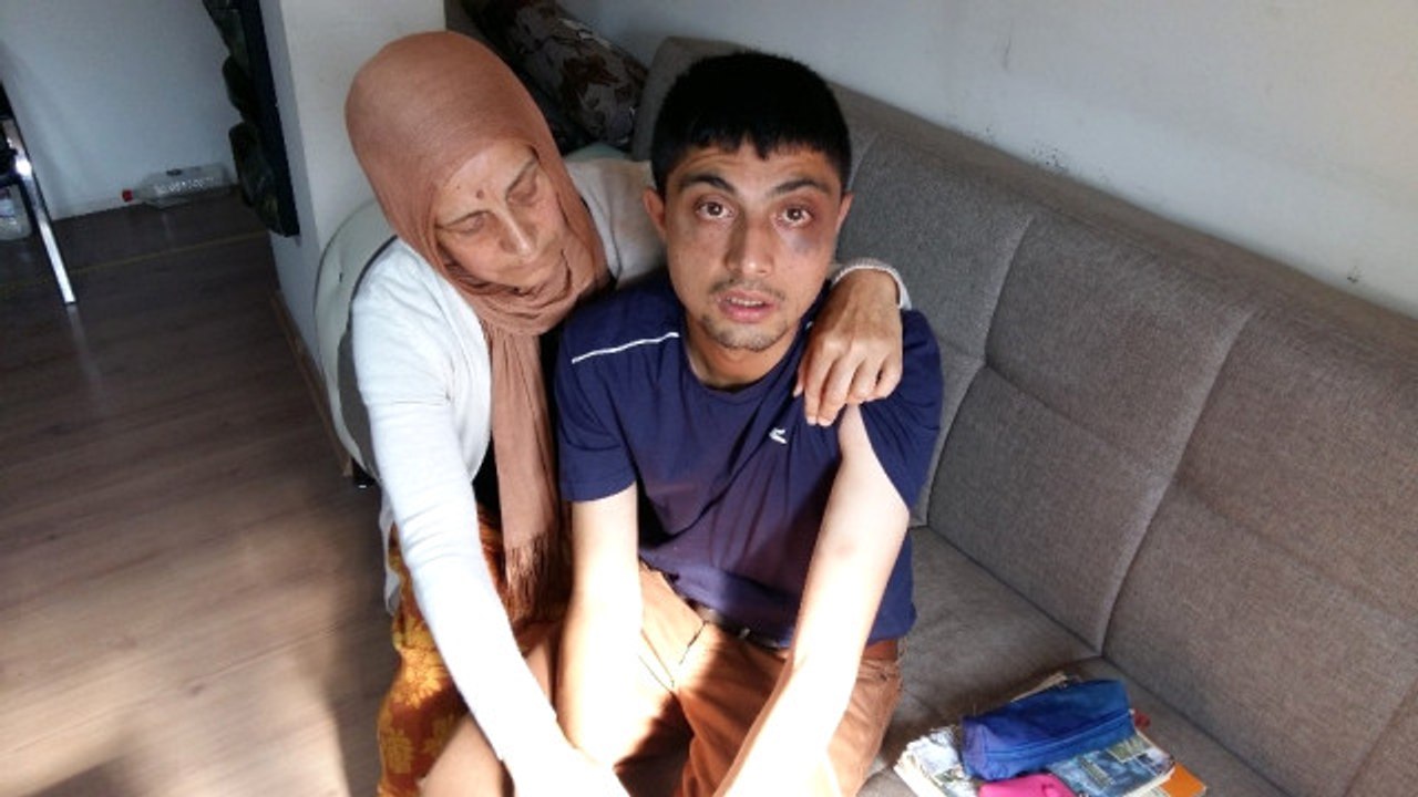 Gözü Dönmüş Caniler, Engelli Genci Tekme Tokat Dövdü