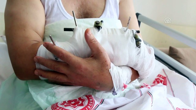 Ayıların saldırısından nacak sayesinde kurtuldu - SİVAS