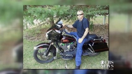 Man loses legs to dangerous infection from dog saliva