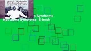 Popular  He Has Up Syndrome Not Down Syndrome  E-book