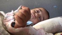 Film Gibi Olay...ölü Denilen Bebek 1,5 Yaşına Girdi