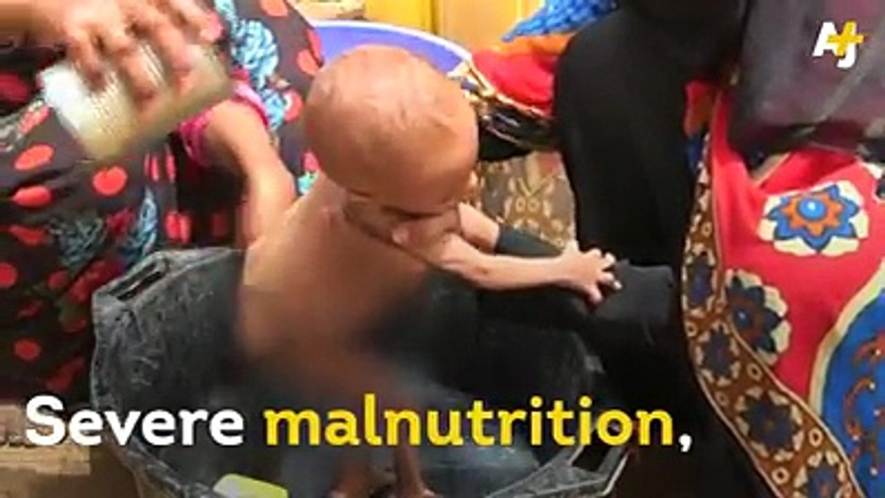 Baby Sakr's mom walked 19 miles to a medical center in Yemen when he started suffering from malnutrition.