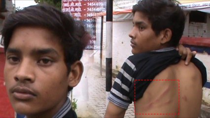 मामूली बात पर प्रिंसिपल ने की छात्रा की पिटाई, अब झूठे मुकदमें फंसाने के दे रहे है धमकी