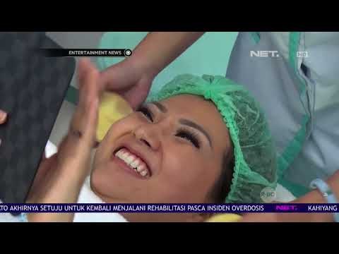 Sarwendah Menjalani Treatment Tanam Benang