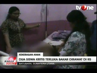 Perkelahian Siswa SD, 2 Orang Mengalami Luka Bakar