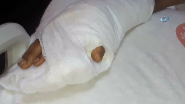 El Parmağı Kopan Çocuğun Eline, Ayak Parmağı Nakledildi