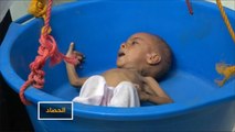 خيارات المجتمع الدولي لإنهاء المأساة الإنسانية باليمن