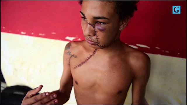 Jovem agredido com estilete conta como foi o caso