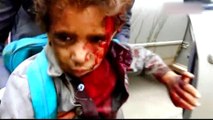 Yemen: Dozens of civilians killed in school bus attack