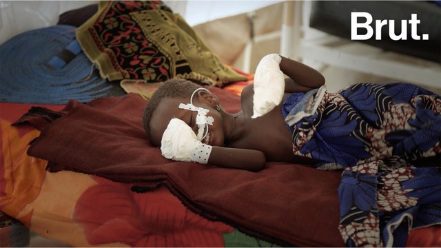 Dans un hôpital d'urgence du Tchad avec les équipes de MSF