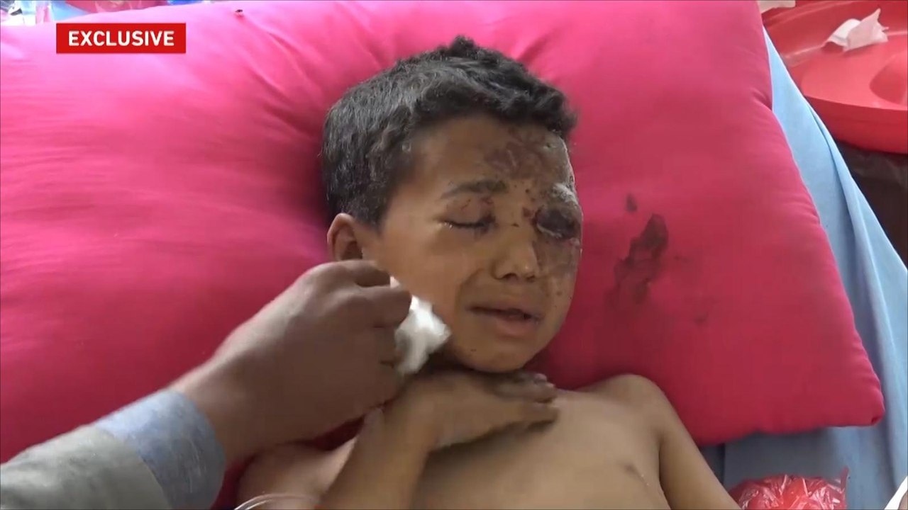 ارتفاع عدد ضحايا مجزرة صعدة لـ130 شخصا معظمهم أطفال