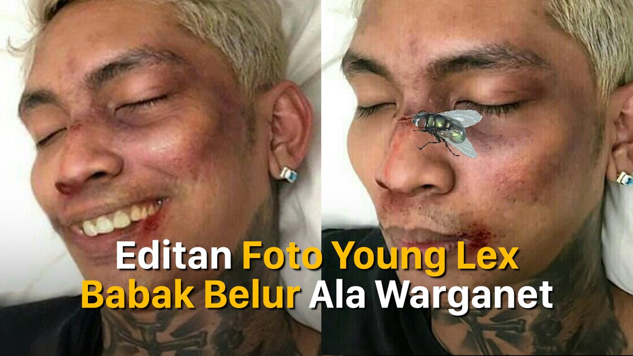 Editan Foto Young Lex Babak Belur Ala Warganet