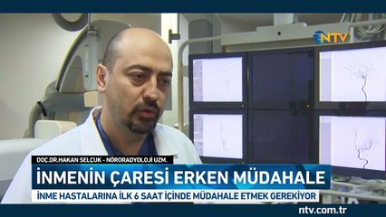 Türkiye'de her 3 dakikada bir kişi inme geçiriyor... Peki çaresi ne?