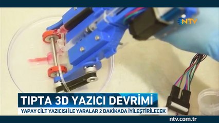 3D yazıcı ile yaralar 2 dakikada iyileşecek (Tıpta devrim)