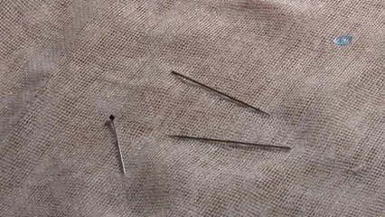 Kedi Üzerine Atlayınca 15 İğne Yuttu