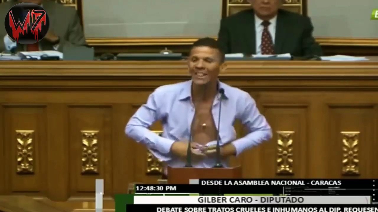 diputado opositor venezolano se desvistió en el Parlamento como protesta por las torturas a Juan Requesens