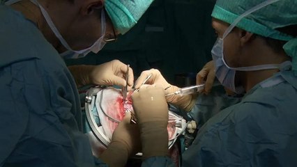 Erstmals in Europa: Mit Laser gegen Epilepsie