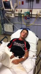 After Surgery Silliness