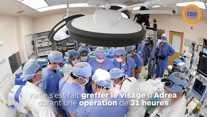 Greffée du visage après avoir essayé d'en finir