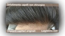 Protesi capelli per uomo e donna a Fiumicino Aprilia Pomezia Tivoli Anzio di LuigiUomo. Le migliori per qualità durata e prezzo.