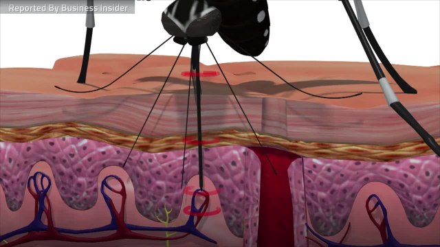 Mosquito Bite Or Bed Bug Bite? How To Tell The Difference