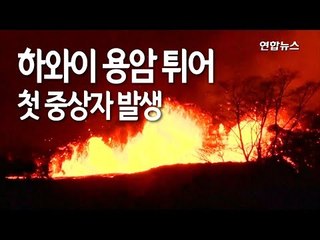 [현장] 하와이 용암 튀어 첫 중상자 발생 / 연합뉴스 (Yonhapnews)