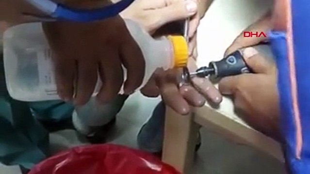 Parmağında sıkışan yüzüğü AFAD ekibi böyle çıkardı