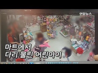 [제보] "5살 아이 개에 물렸는데 주인 나몰라라" 개물림 피해 속출/ 연합뉴스 (Yonhapnews)