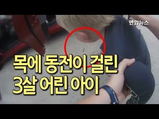 '목에 동전이'…미국 경찰관, 기도 막힌 세 살배기 살려 / 연합뉴스 (Yonhapnews)