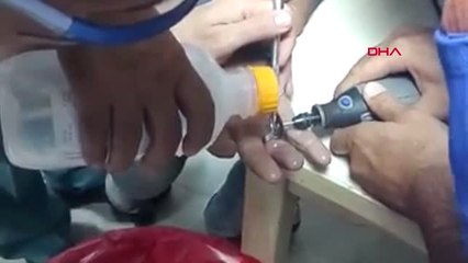 Zonguldak Parmağında Sıkışan Yüzüğü Afad Çıkardı