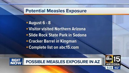 Potential measles exposure reported in northern Arizona