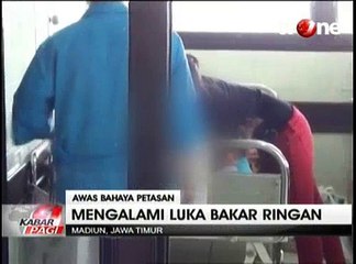 Seorang Balita Terkena Ledakan Petasan Milik Ayahnya
